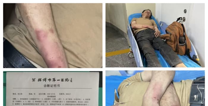 住酒店发生纠纷 湘访民胡正秋遭警察殴打致晕