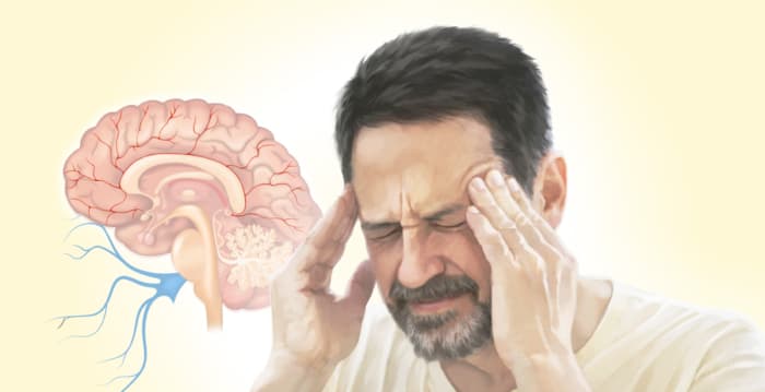 偏头痛不只是头痛 它是最常被误诊的神经疾病
