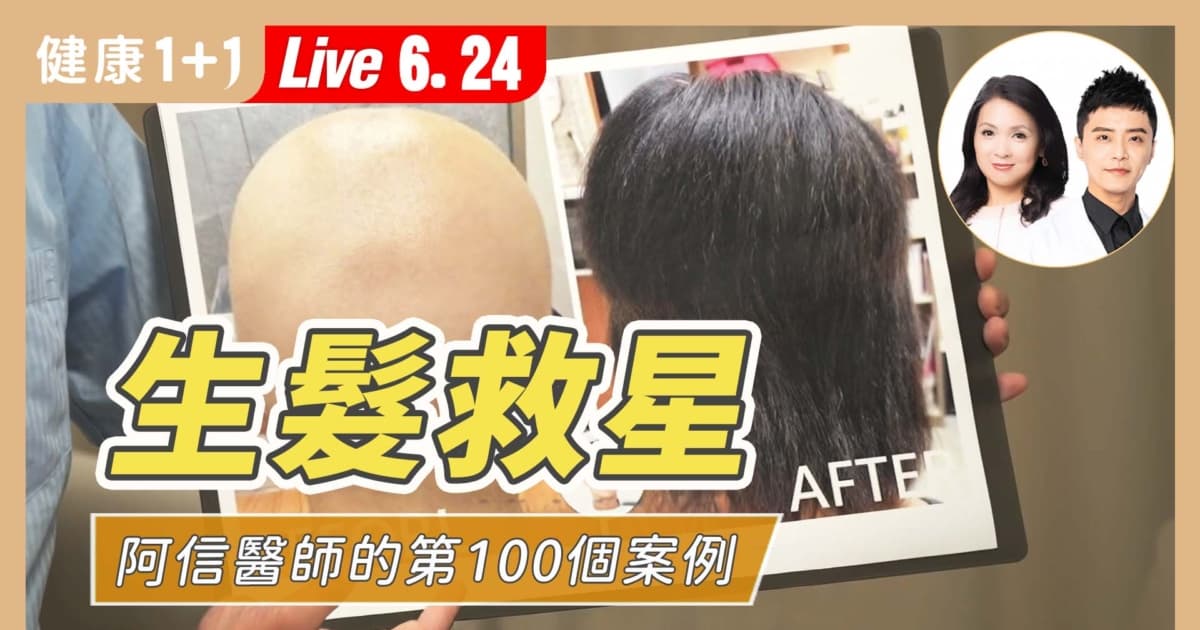 【健康1+1】生髮救星 阿信醫師的第100個案例