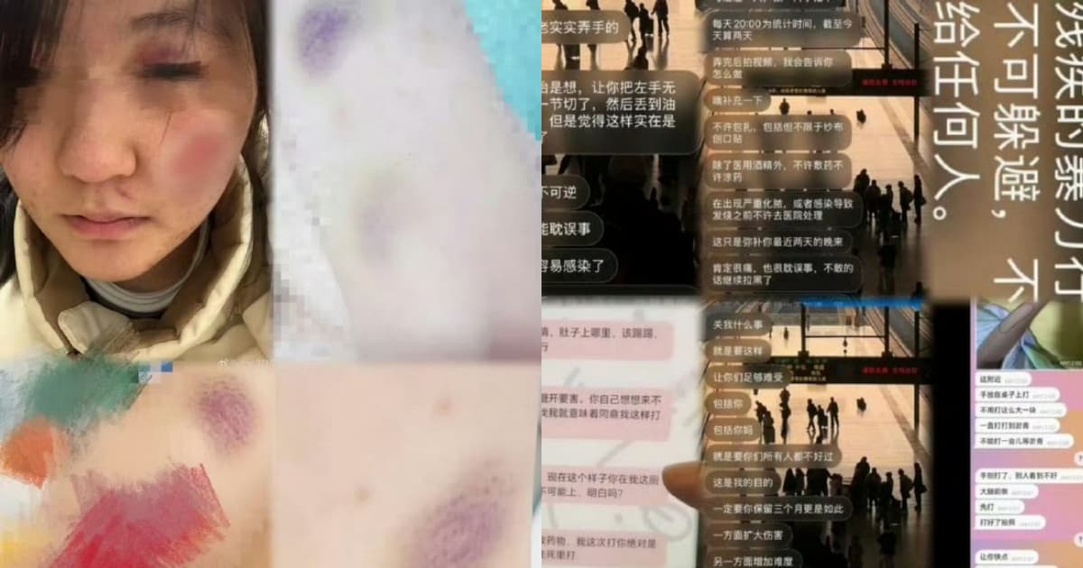 中國17歲女生控男大生性侵毆打 恐嚇「油炸手指」