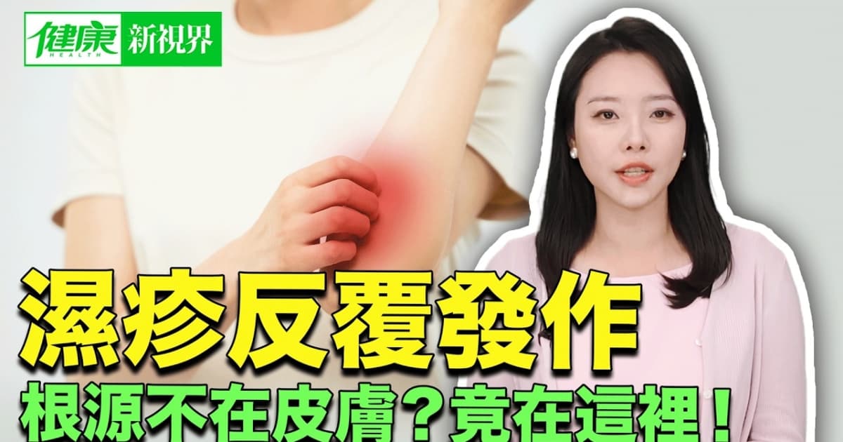 【健康新視界】濕疹反覆發作 根源不在皮膚?