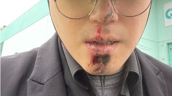 香港议会议长姜嘉伟遇袭受伤 六四前夕的政治恐吓(组图)